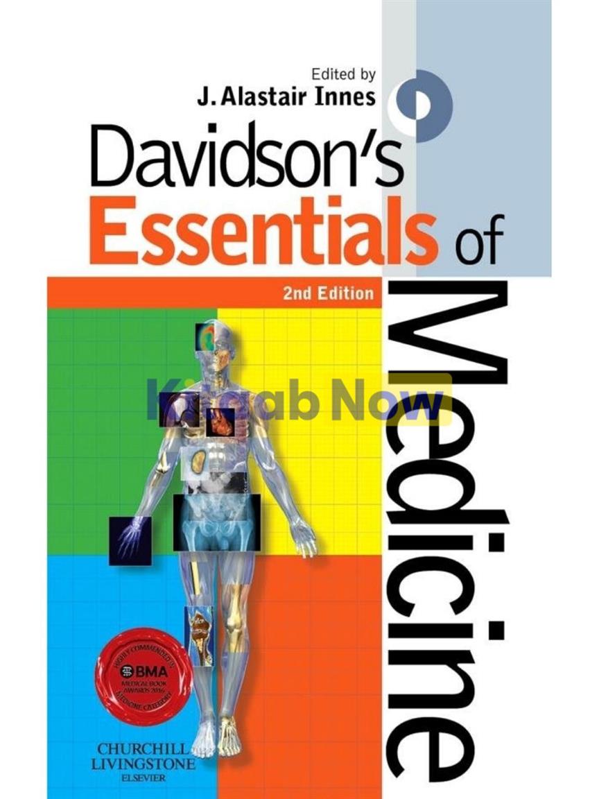 DAVIDSONS ESSENTIALS OF MEDICINE DAVIDSON SECOND